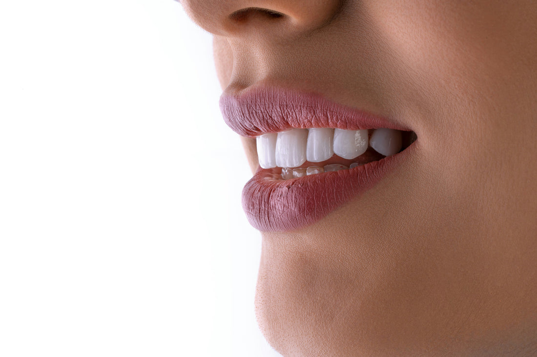 Has the Teeth Whitening Craze Gone Too Far?